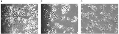 Effect of total glycosides of Cistanche deserticola on the energy metabolism of human HepG2 cells